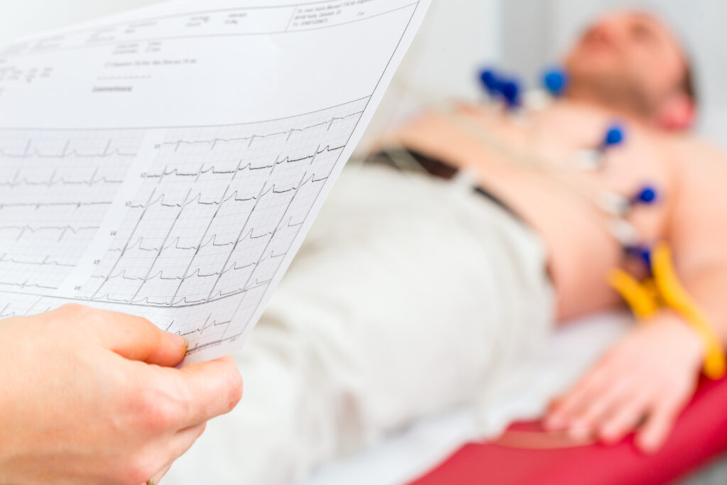 Electrocardiogram (ECG)