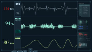 Cardiology Holter Monitoring