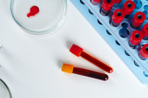 HbA1c Test