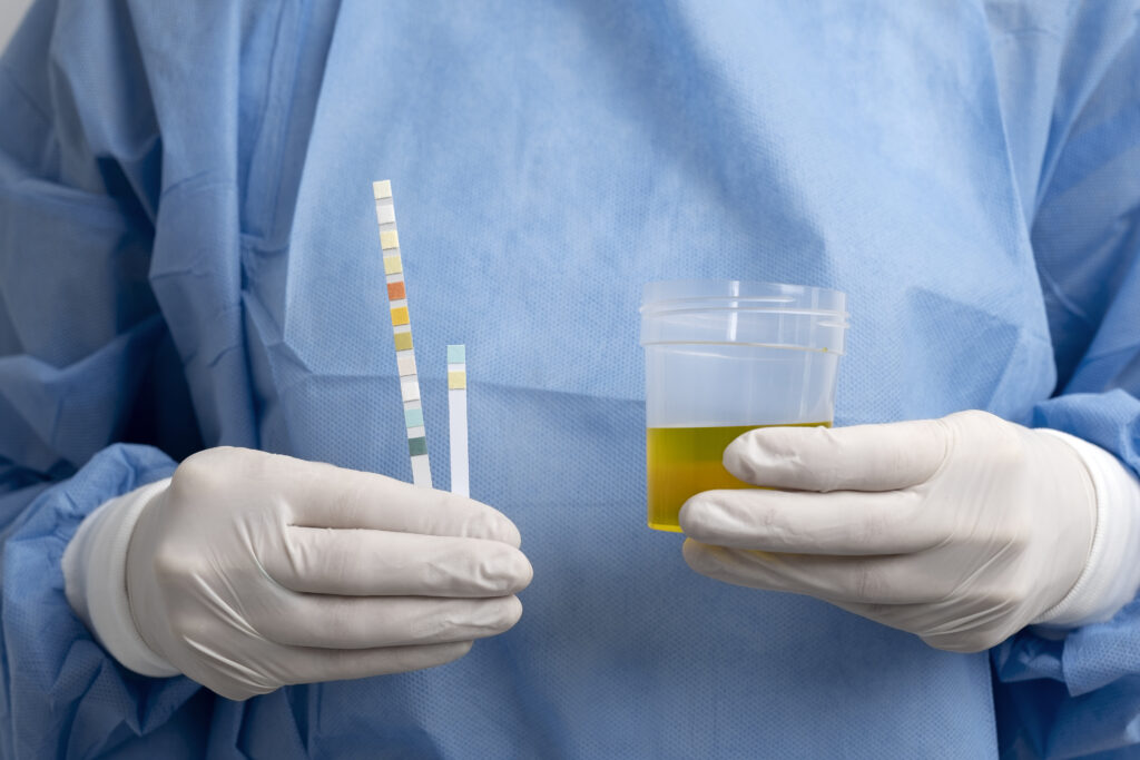 Urinalysis and Stool Tests