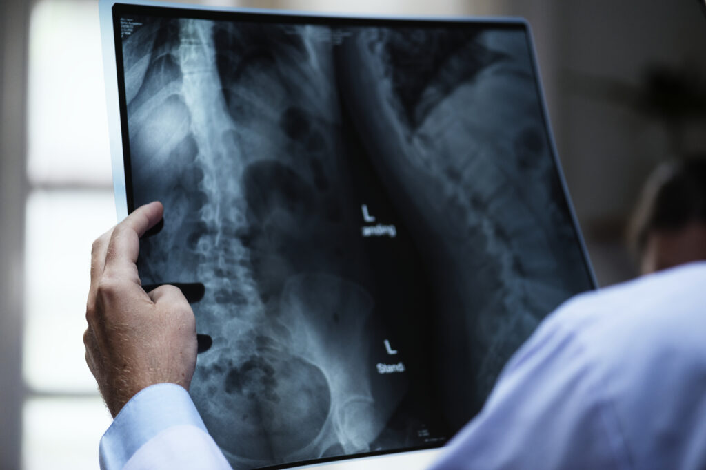 General Medicine X Ray