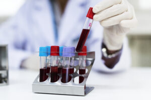 Neurology Blood Test