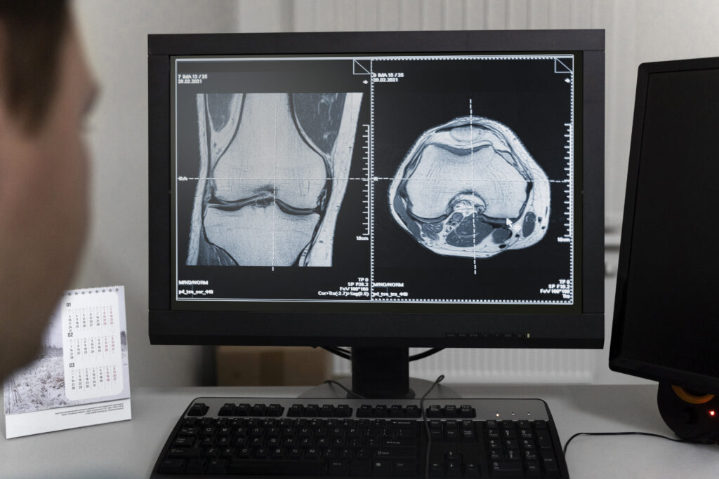 Orthopedic Bone Scan