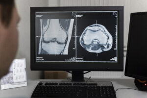 Orthopedic Bone Scan