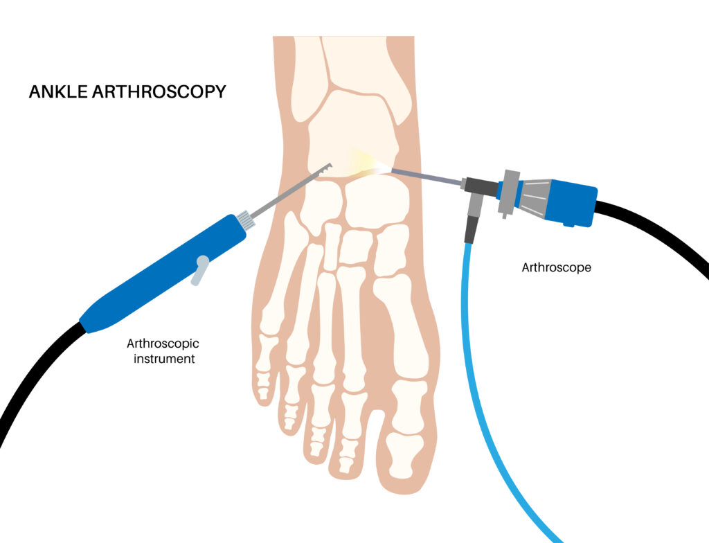 Orthopedic Arthroscopy