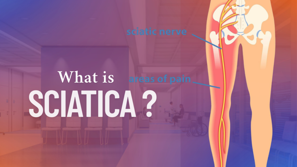 Disc Sciatica: Causes, Treatment & Prevention Tips