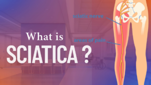 Disc Sciatica: Causes, Treatment & Prevention Tips