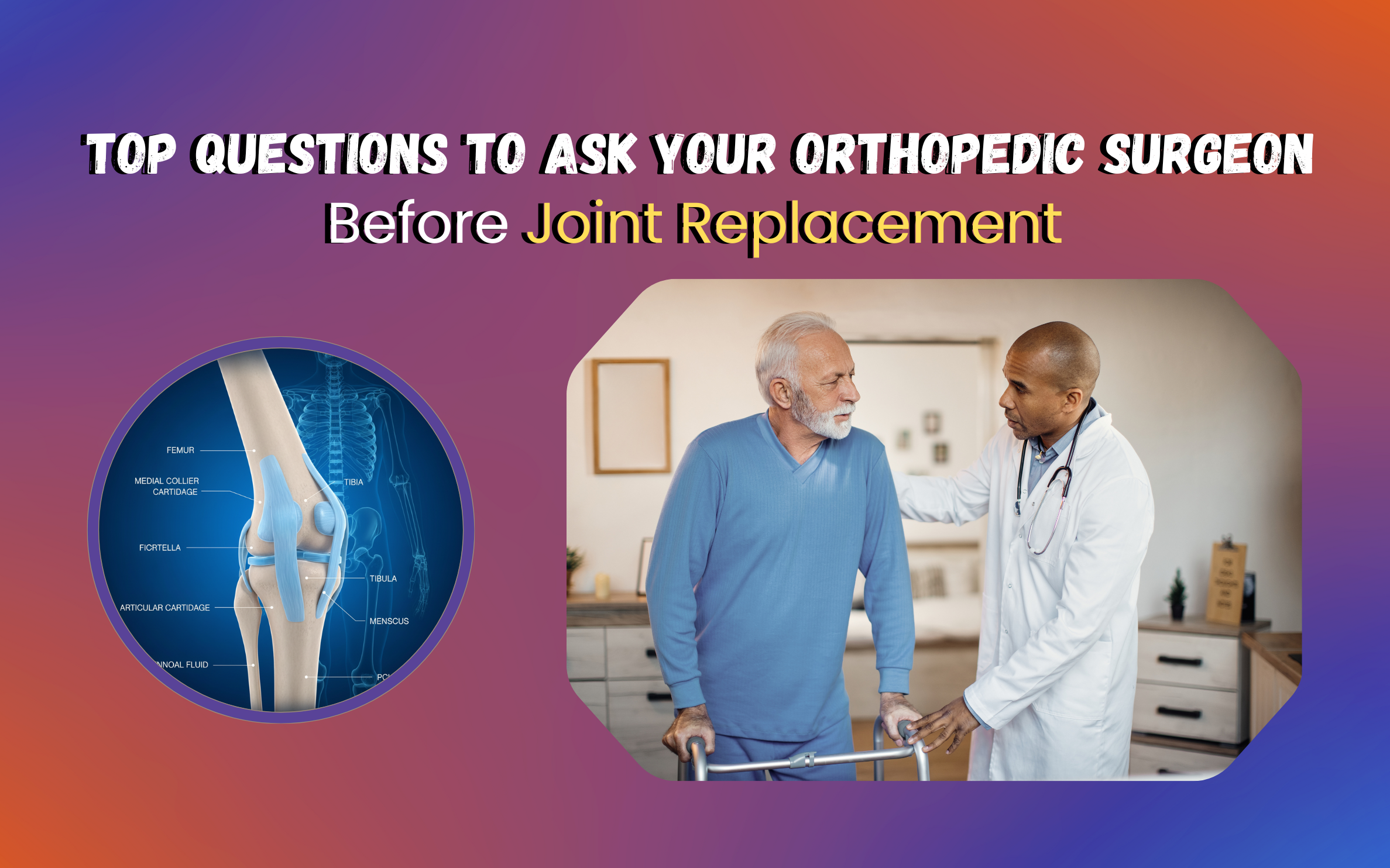 Questions to Ask Your Orthopedic Surgeon Before Surgery