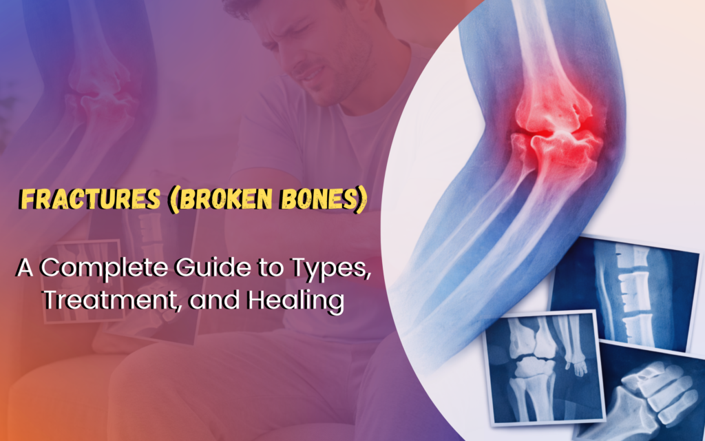 Fractures (Broken Bones): A Complete Guide to Types, Treatment, and Healing