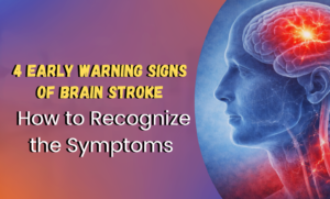 Brain stroke