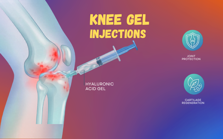 Knee Pain After 40? Here’s What You Need to Know About Gel Injections