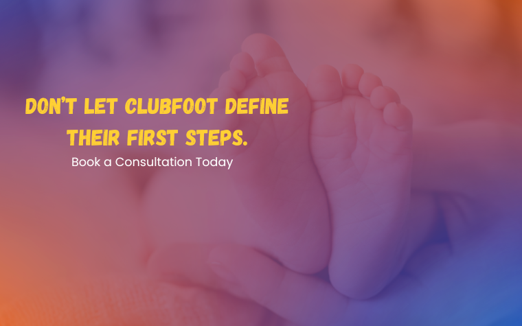 Clubfoot: Early Correction, Lifelong Confidence