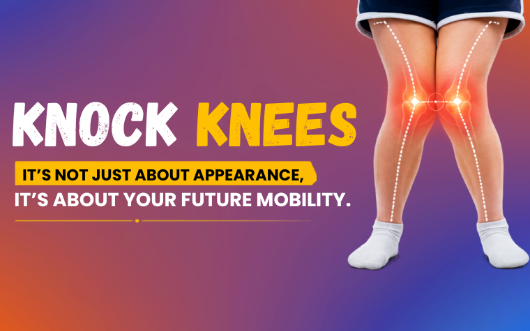 The Silent Orthopedic Condition That Slowly Disturbs Body Balance