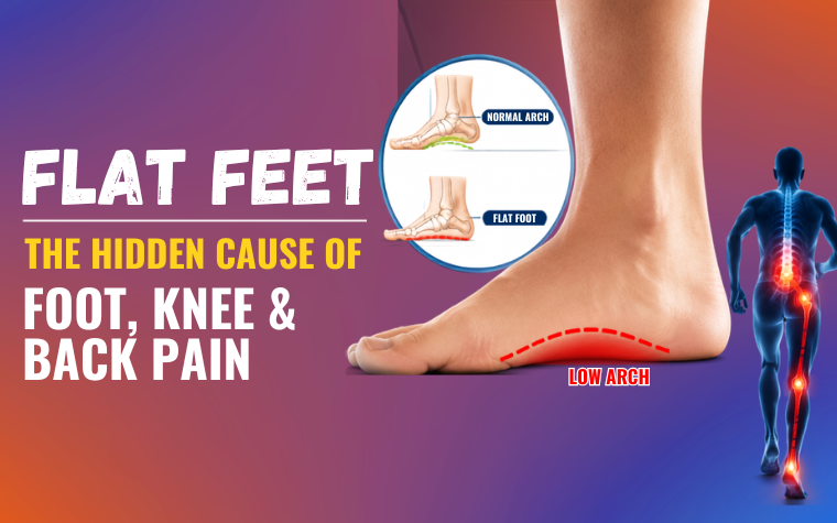 The Silent Posture Problem That Could Be Causing Your Foot, Knee, and Back Pain
